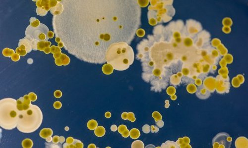 Fight against pollution: New plastic-eating fungi may help for recycling